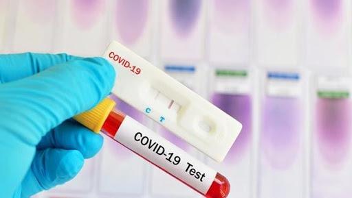 36 PCR laboratories responding to COVID-19 nationwide